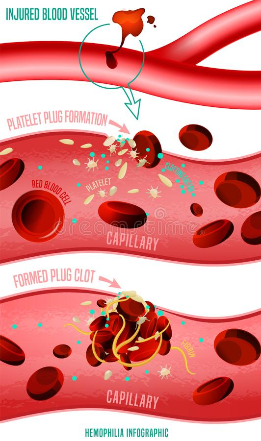 Plan De Caillots Sanguins Illustration De Vecteur avec Vitamine K Dessin